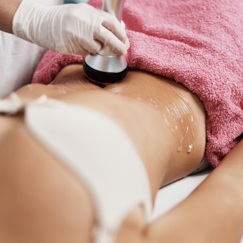 radio frequency treatment illustration